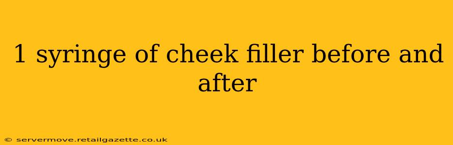 1 syringe of cheek filler before and after