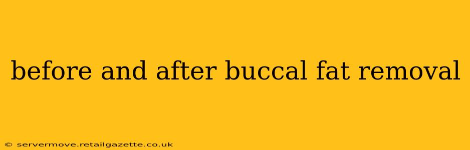 before and after buccal fat removal