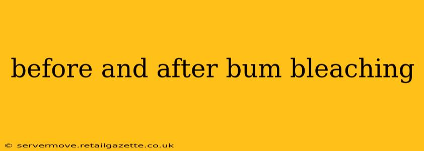 before and after bum bleaching