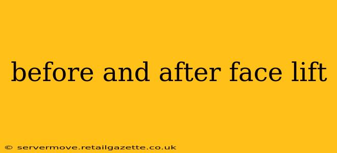 before and after face lift