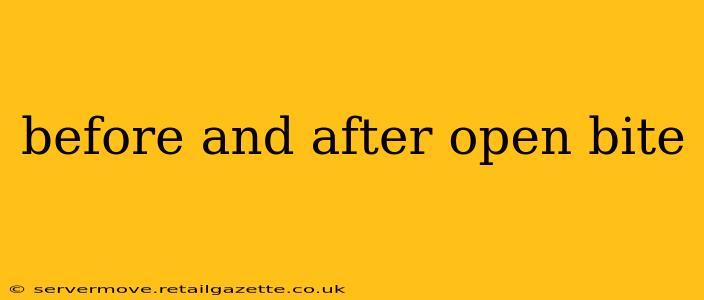 before and after open bite