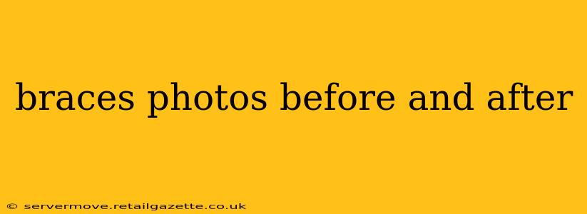 braces photos before and after