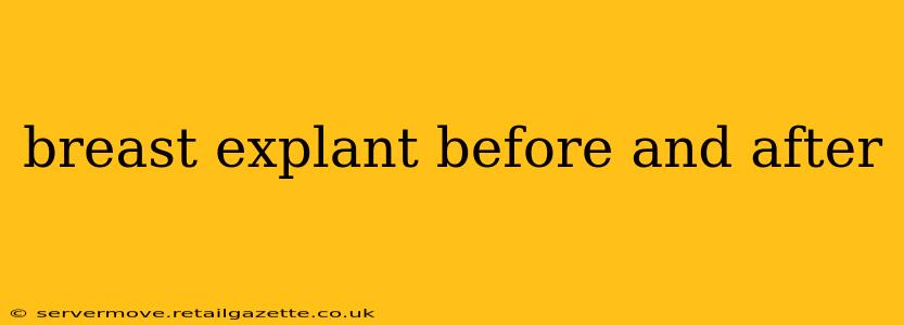 breast explant before and after