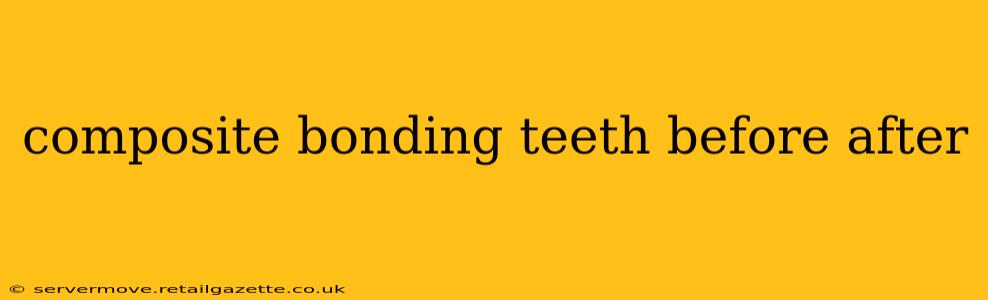 composite bonding teeth before after