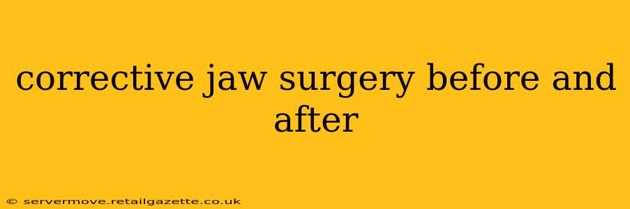 corrective jaw surgery before and after