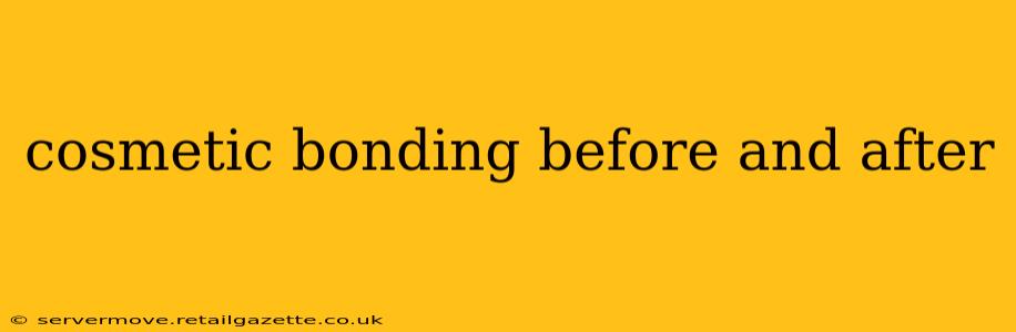 cosmetic bonding before and after