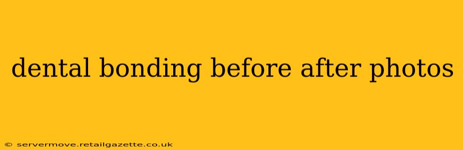 dental bonding before after photos
