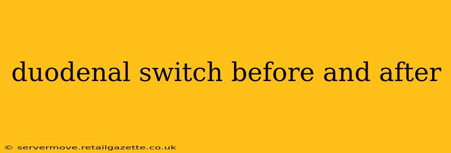 duodenal switch before and after