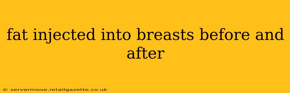 fat injected into breasts before and after