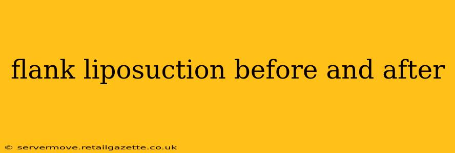 flank liposuction before and after