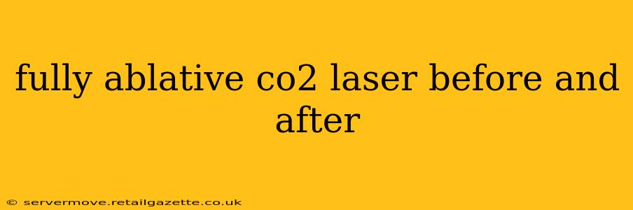 fully ablative co2 laser before and after