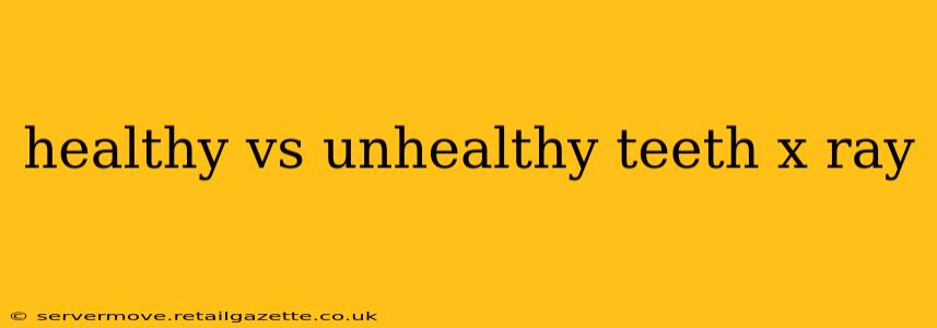 healthy vs unhealthy teeth x ray