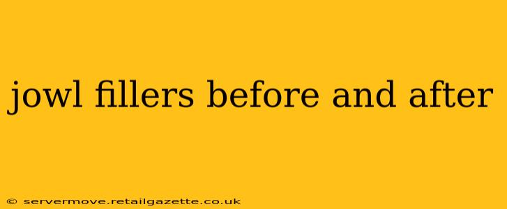 jowl fillers before and after