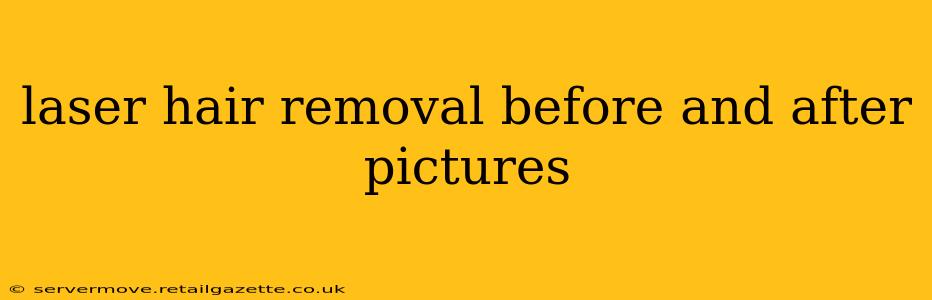 laser hair removal before and after pictures