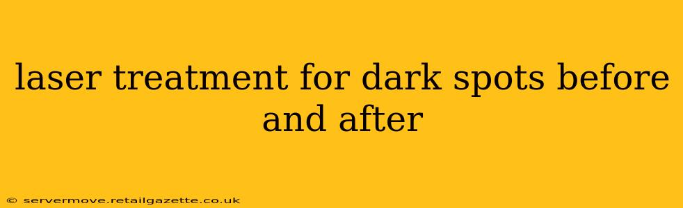 laser treatment for dark spots before and after