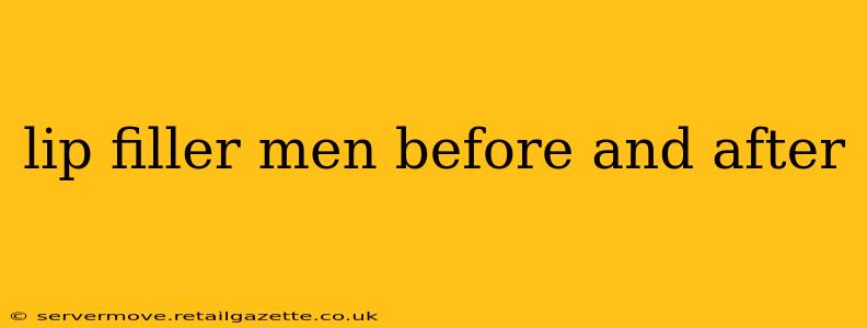 lip filler men before and after