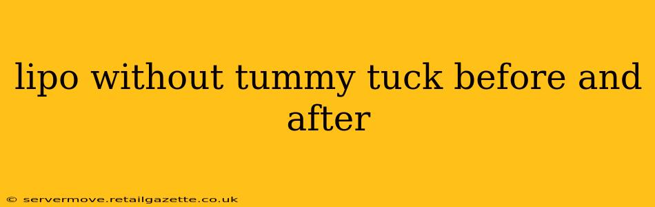 lipo without tummy tuck before and after