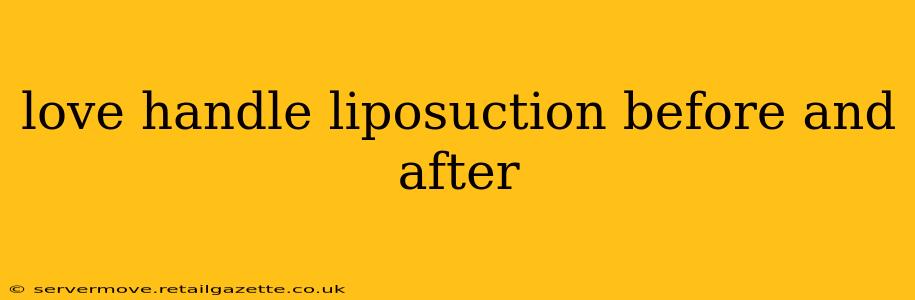 love handle liposuction before and after