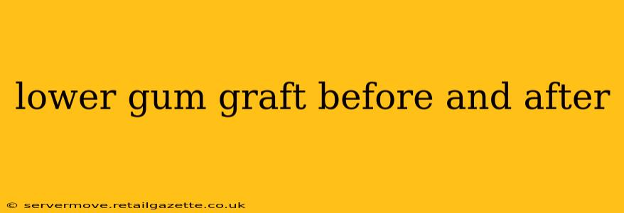 lower gum graft before and after