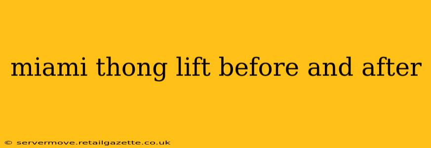 miami thong lift before and after