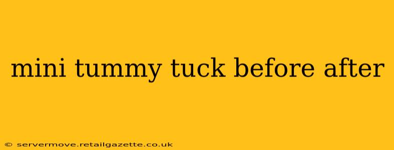mini tummy tuck before after