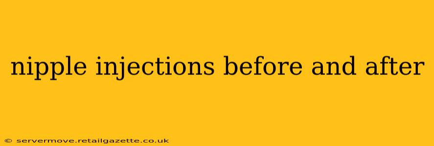 nipple injections before and after
