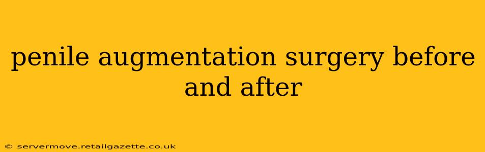 penile augmentation surgery before and after