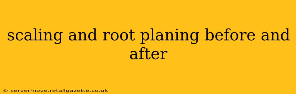 scaling and root planing before and after