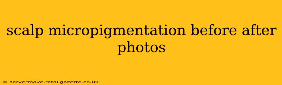 scalp micropigmentation before after photos