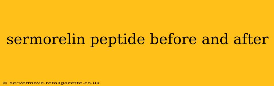 sermorelin peptide before and after