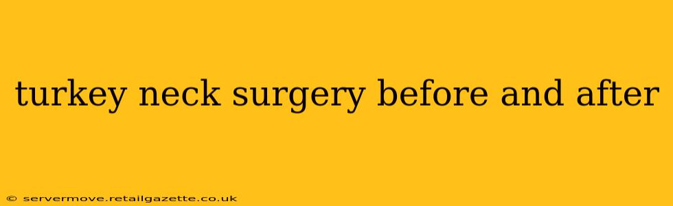turkey neck surgery before and after