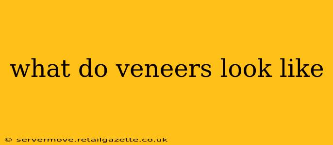 what do veneers look like