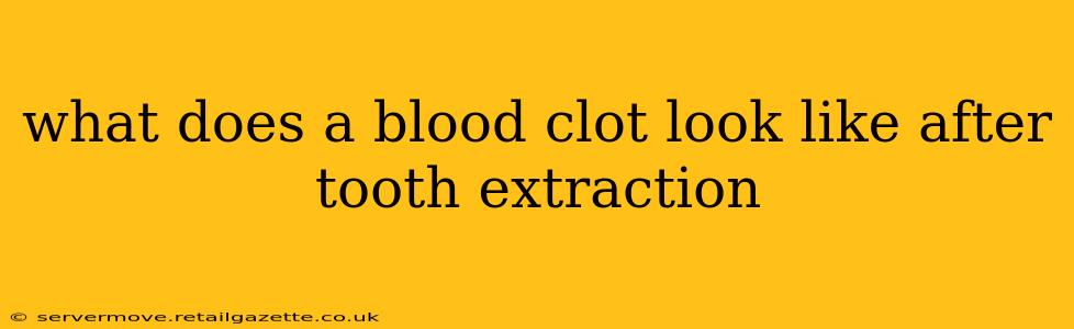 what does a blood clot look like after tooth extraction