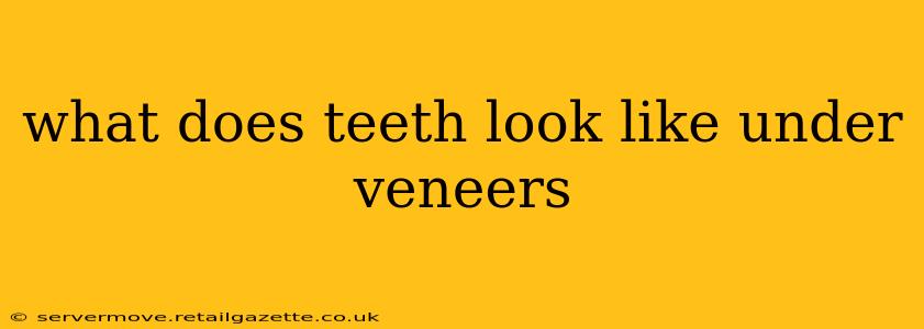 what does teeth look like under veneers