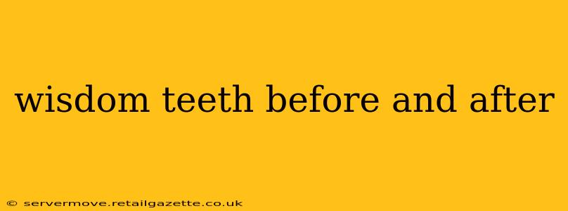 wisdom teeth before and after